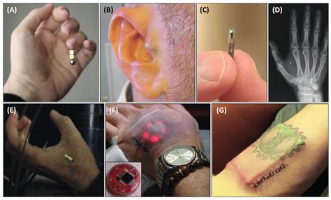 rfid tag under skin|benefits of a rfid implant.